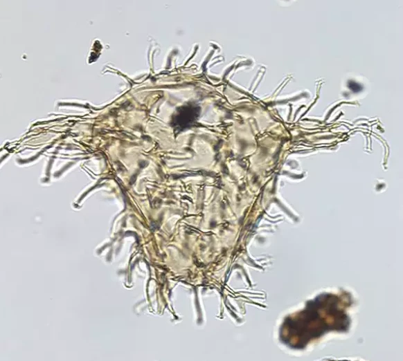 Fotografi Dinoflagellat cyst, fossilt hvilestadie af Eocæn dinoflagellat