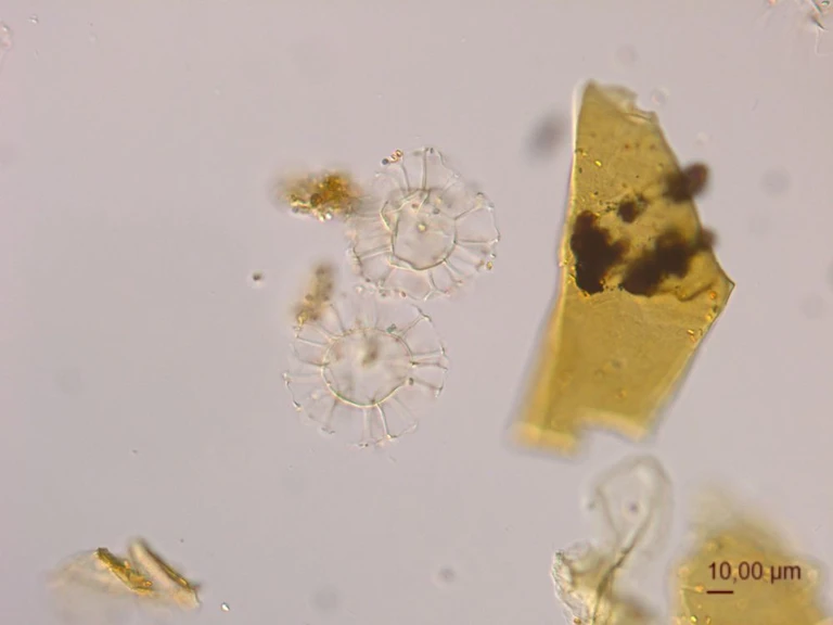 dinoflagellat-cyste Nematosphaeropsis labyrinthus gennem mikroskop